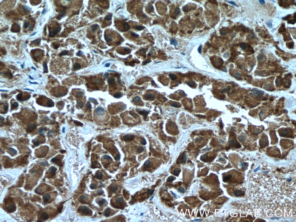 Immunohistochemistry (IHC) staining of human pituitary tissue using Carboxypeptidase E Polyclonal antibody (13710-1-AP)