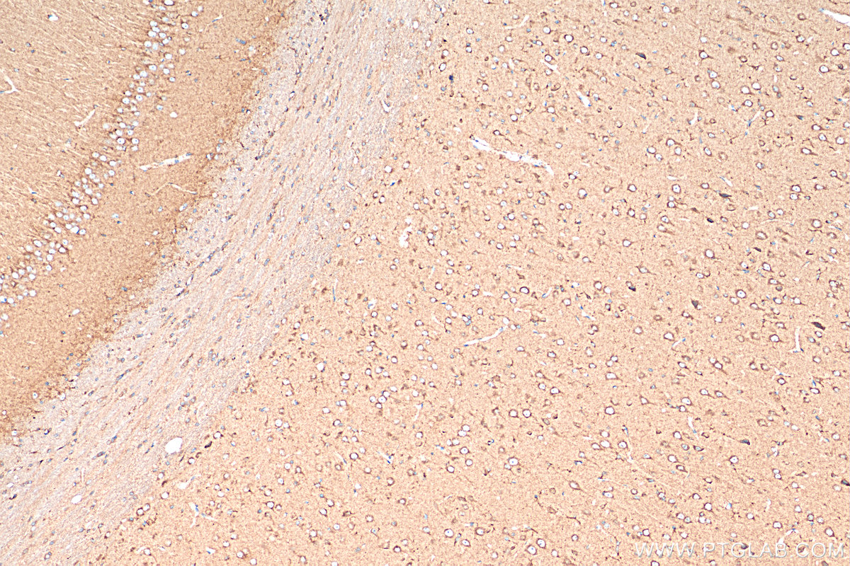 Immunohistochemistry (IHC) staining of rat brain tissue using Carboxypeptidase E Polyclonal antibody (13710-1-AP)