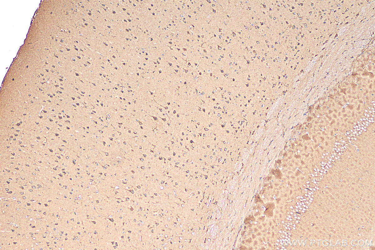 Immunohistochemistry (IHC) staining of mouse brain tissue using Carboxypeptidase E Polyclonal antibody (13710-1-AP)