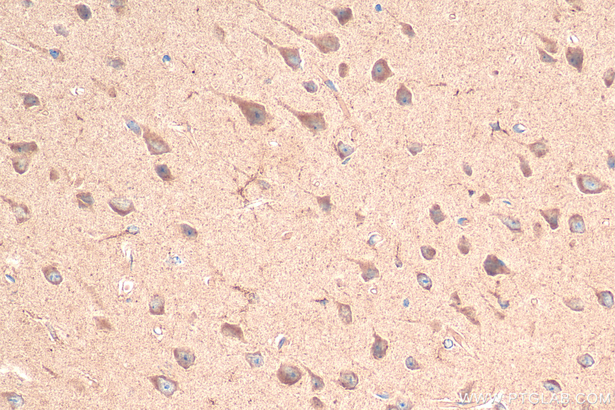 Immunohistochemistry (IHC) staining of mouse brain tissue using Carboxypeptidase E Polyclonal antibody (13710-1-AP)