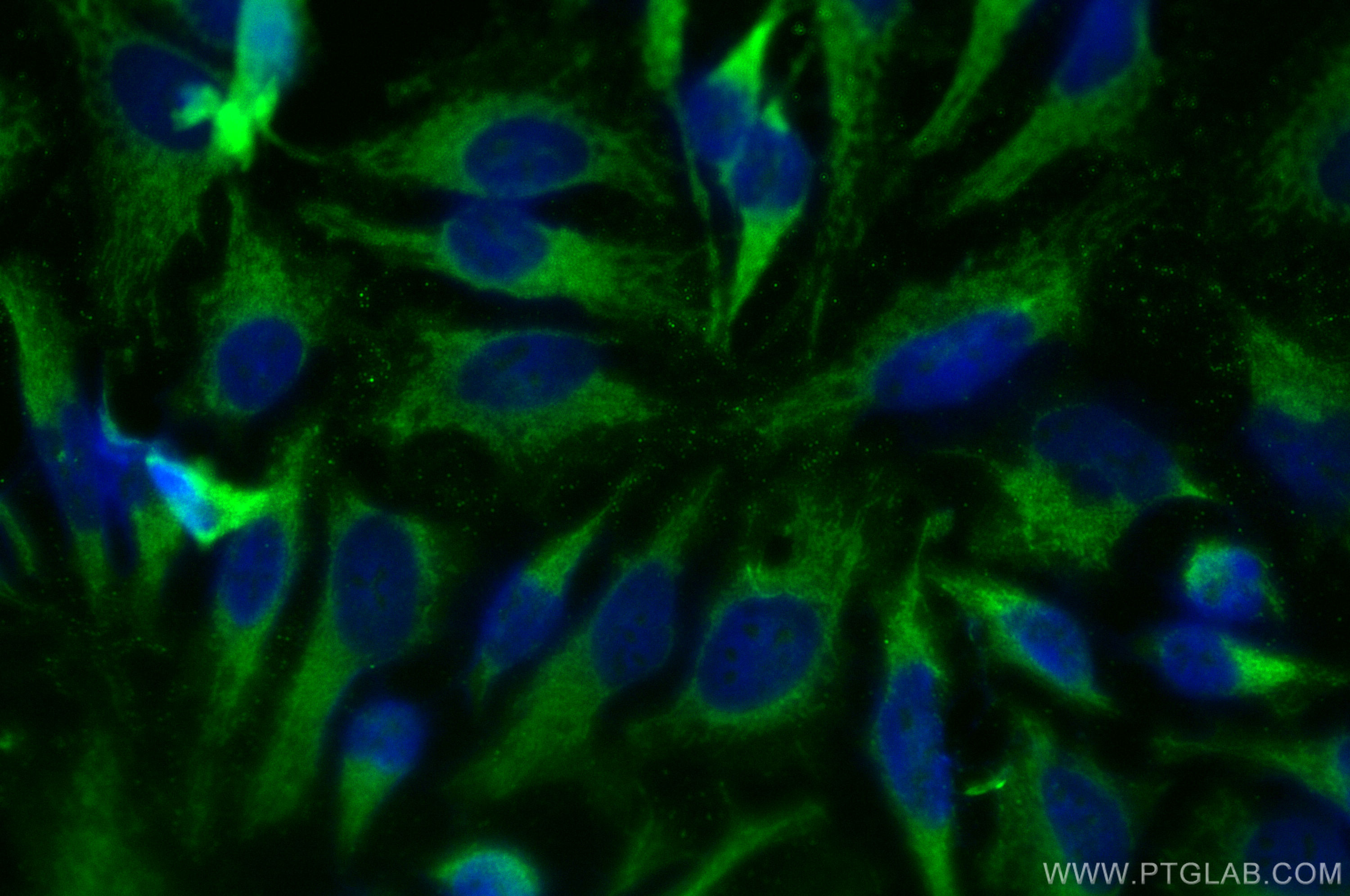 Immunofluorescence (IF) / fluorescent staining of HeLa cells using CPEB1 Polyclonal antibody (13274-1-AP)