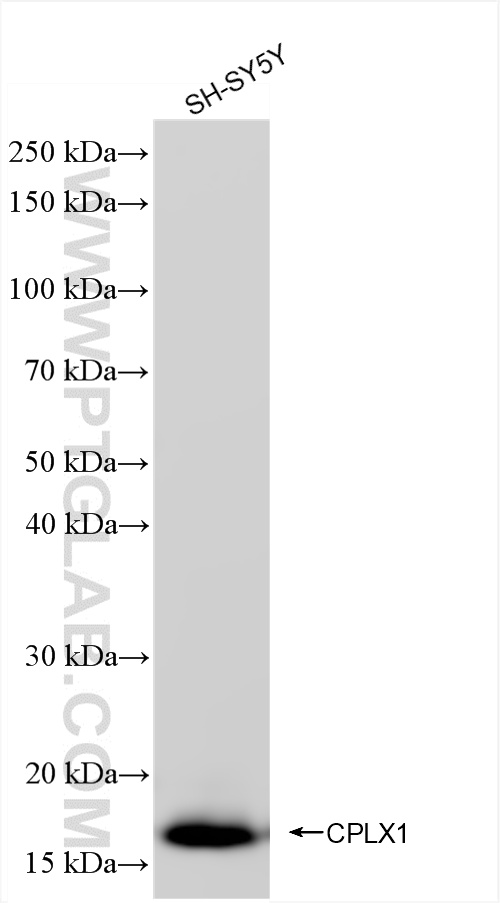 Western Blot (WB) analysis of SH-SY5Y cells using CPLX1 Recombinant antibody (85874-1-RR)