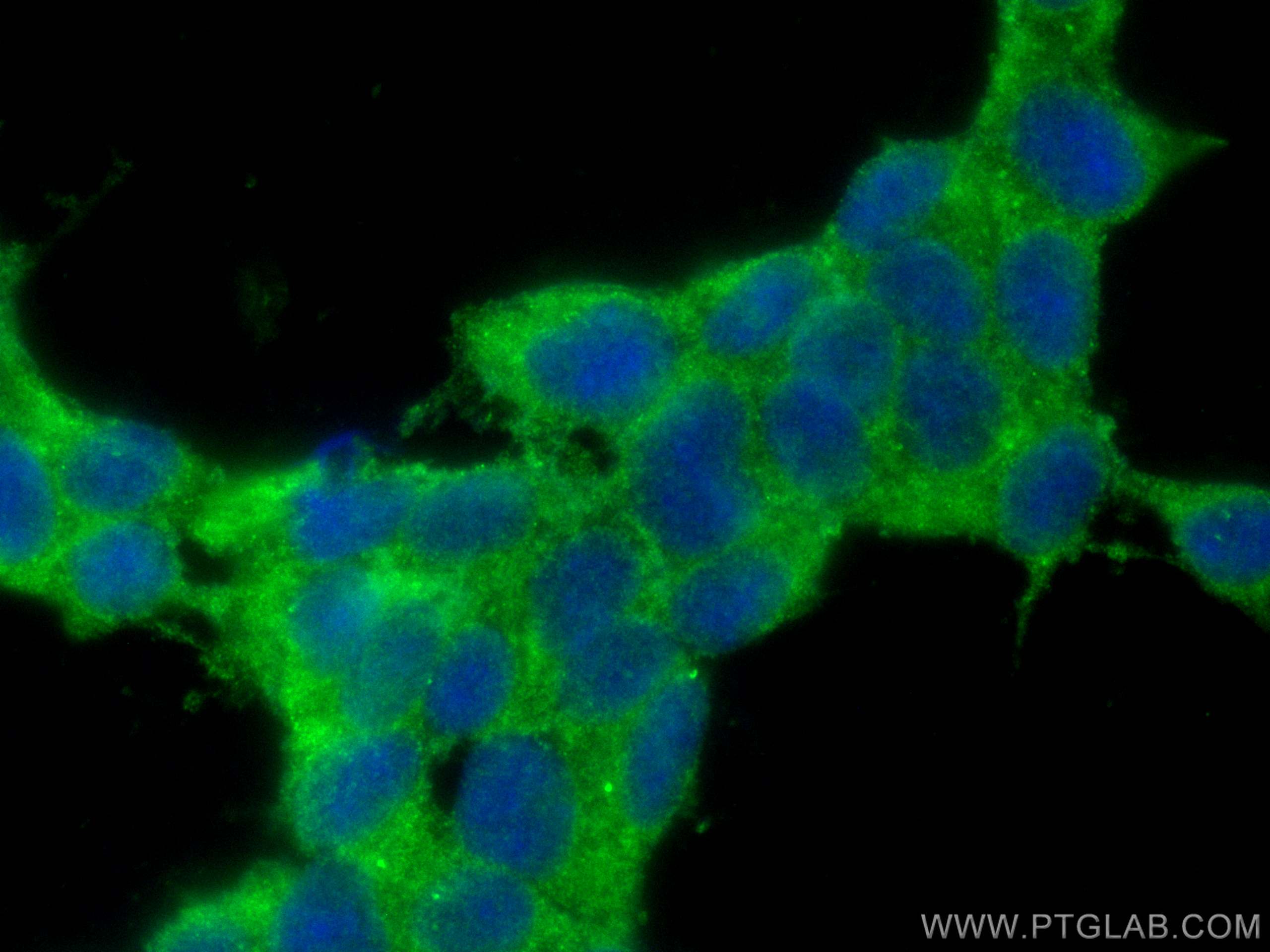Immunofluorescence (IF) / fluorescent staining of SH-SY5Y cells using CoraLite® Plus 488-conjugated CPLX1 Polyclonal ant (CL488-10246)