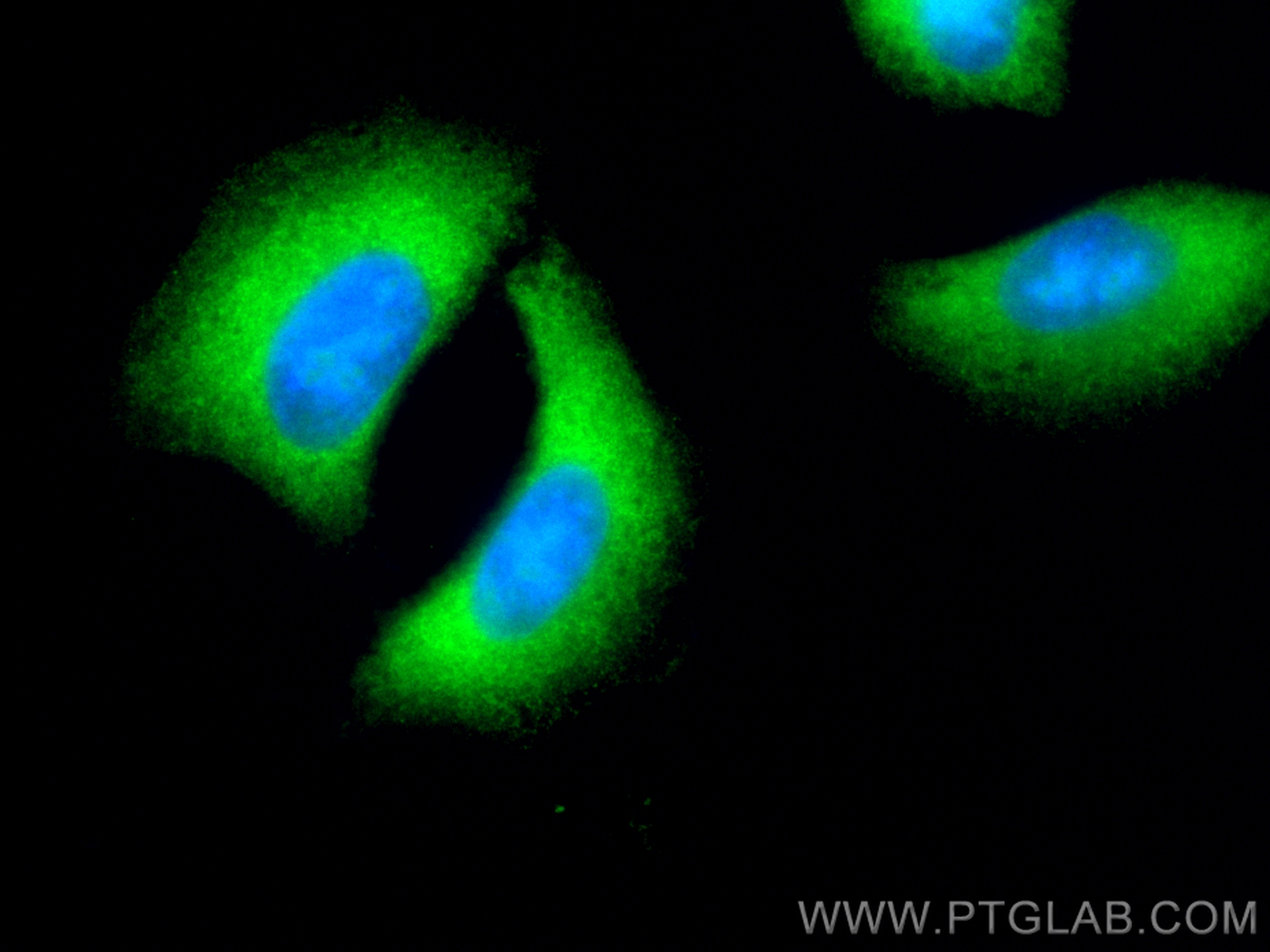 Immunofluorescence (IF) / fluorescent staining of A549 cells using CoraLite® Plus 488-conjugated CPLX2 Polyclonal ant (CL488-18149)