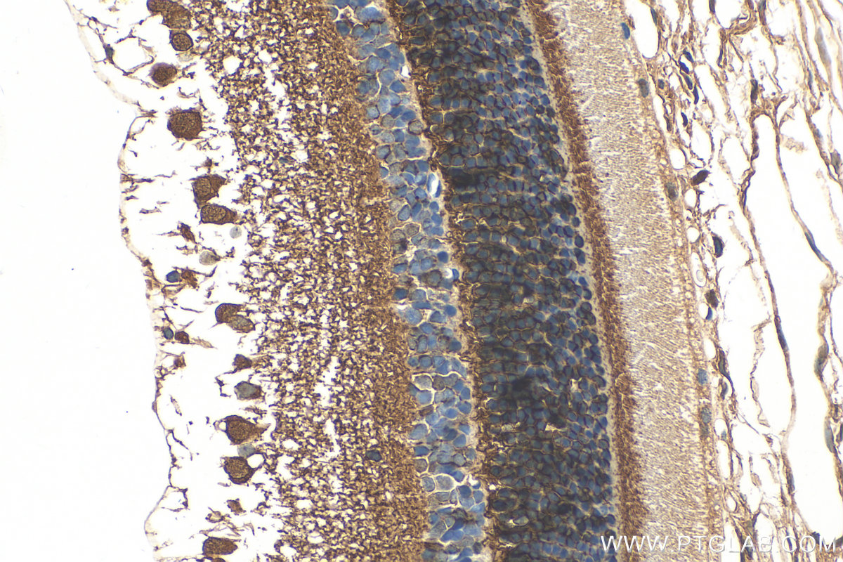 Immunohistochemistry (IHC) staining of rat eye tissue using CPLX4 Polyclonal antibody (21222-1-AP)