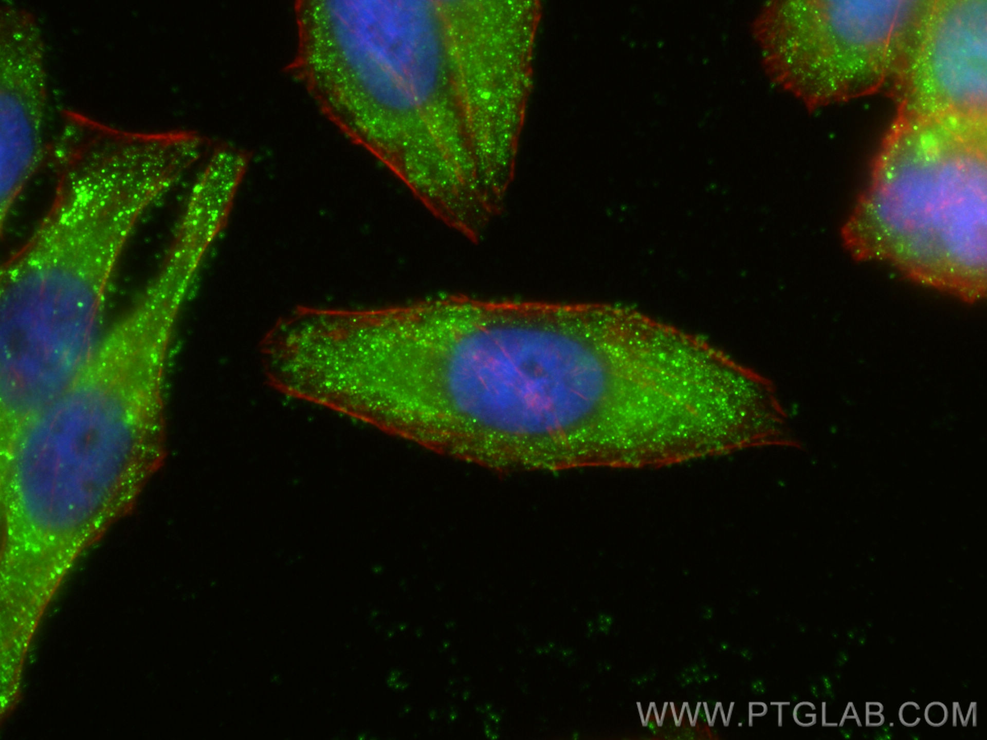 Immunofluorescence (IF) / fluorescent staining of HepG2 cells using CPN1 Polyclonal antibody (13385-1-AP)