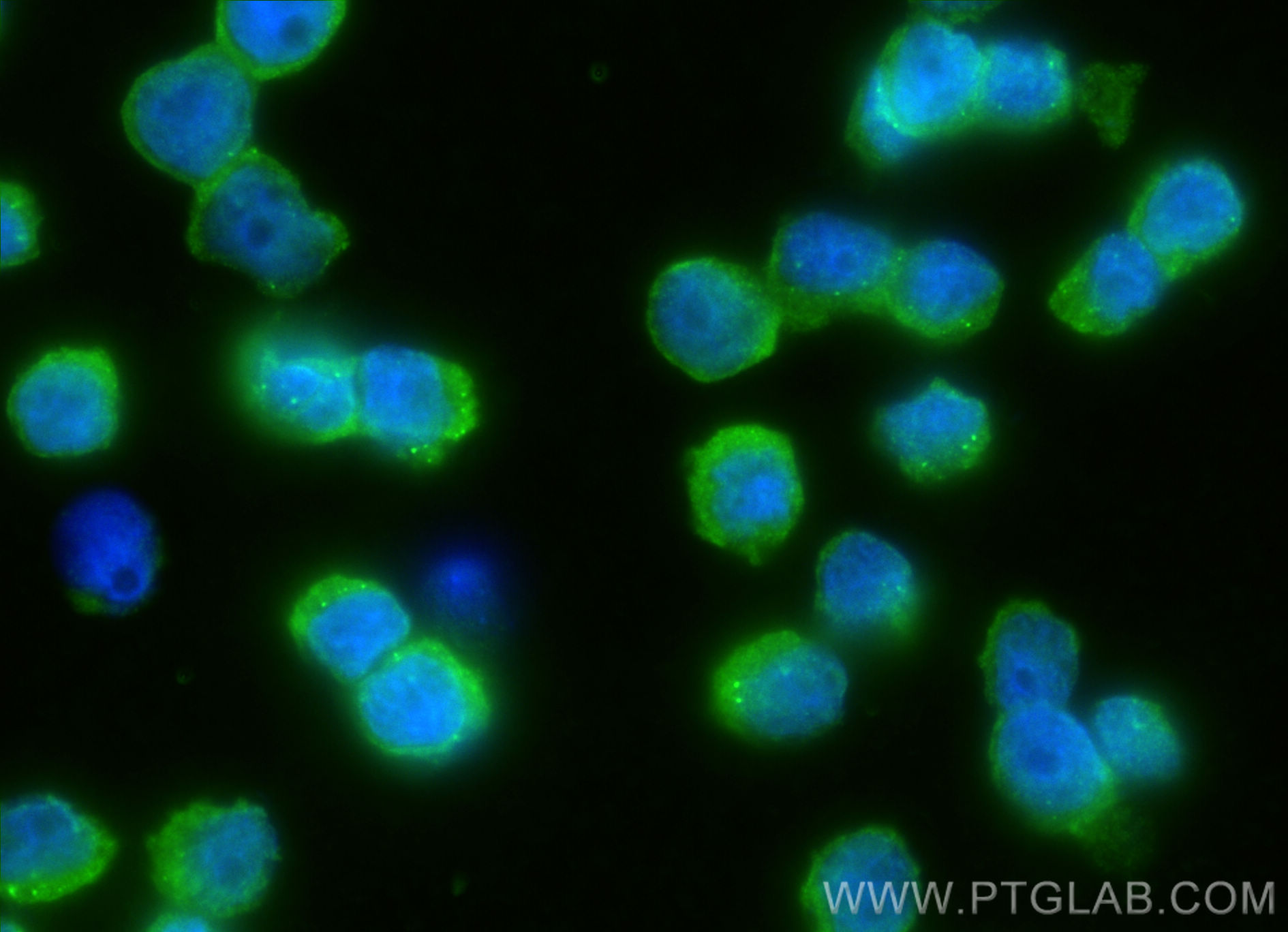 Immunofluorescence (IF) / fluorescent staining of COLO 320 cells using CPN1 Polyclonal antibody (13385-1-AP)