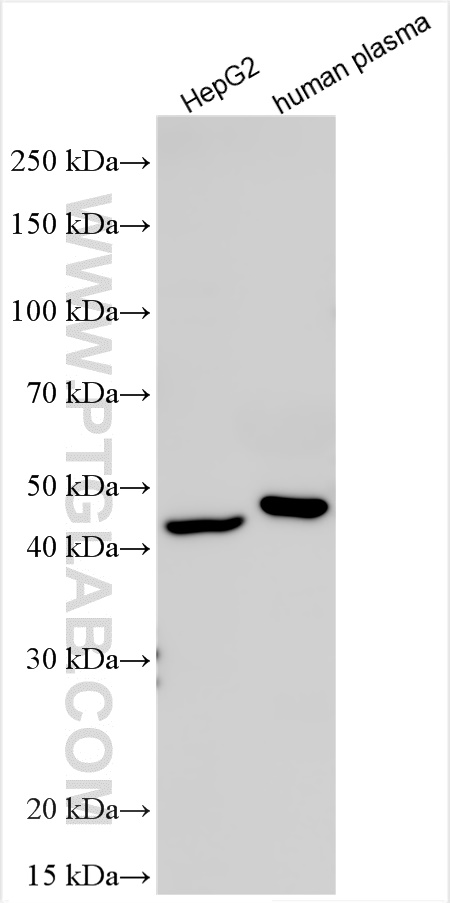 Western Blot (WB) analysis of various lysates using CPN1 Polyclonal antibody (13385-1-AP)