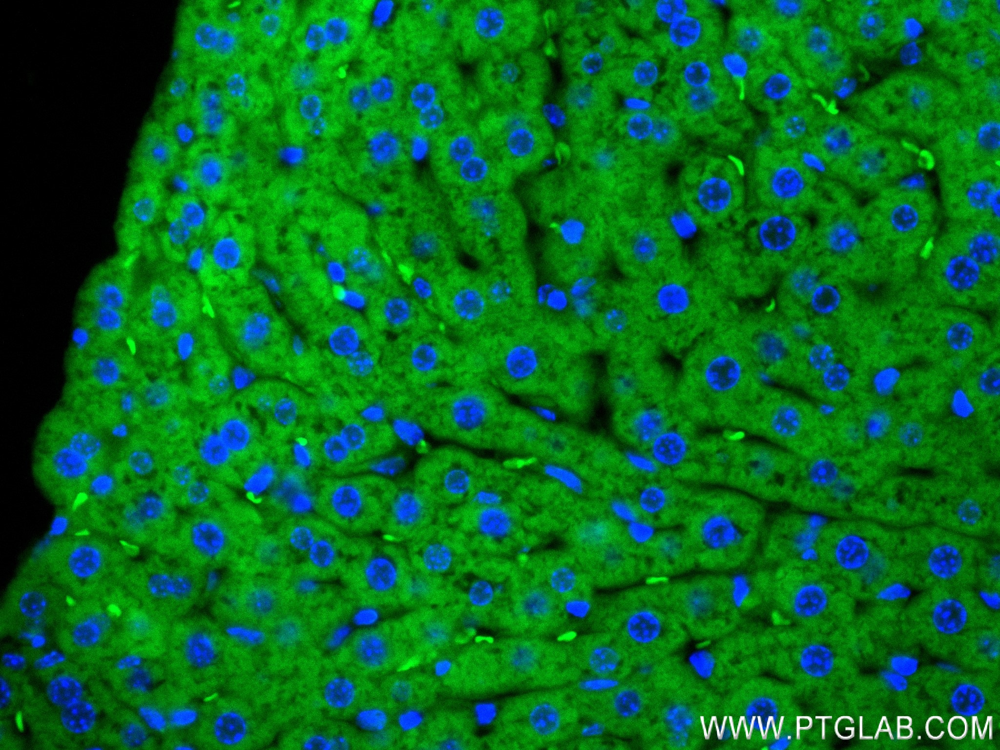 Immunofluorescence (IF) / fluorescent staining of mouse liver tissue using CPN1 Recombinant antibody (84218-1-RR)