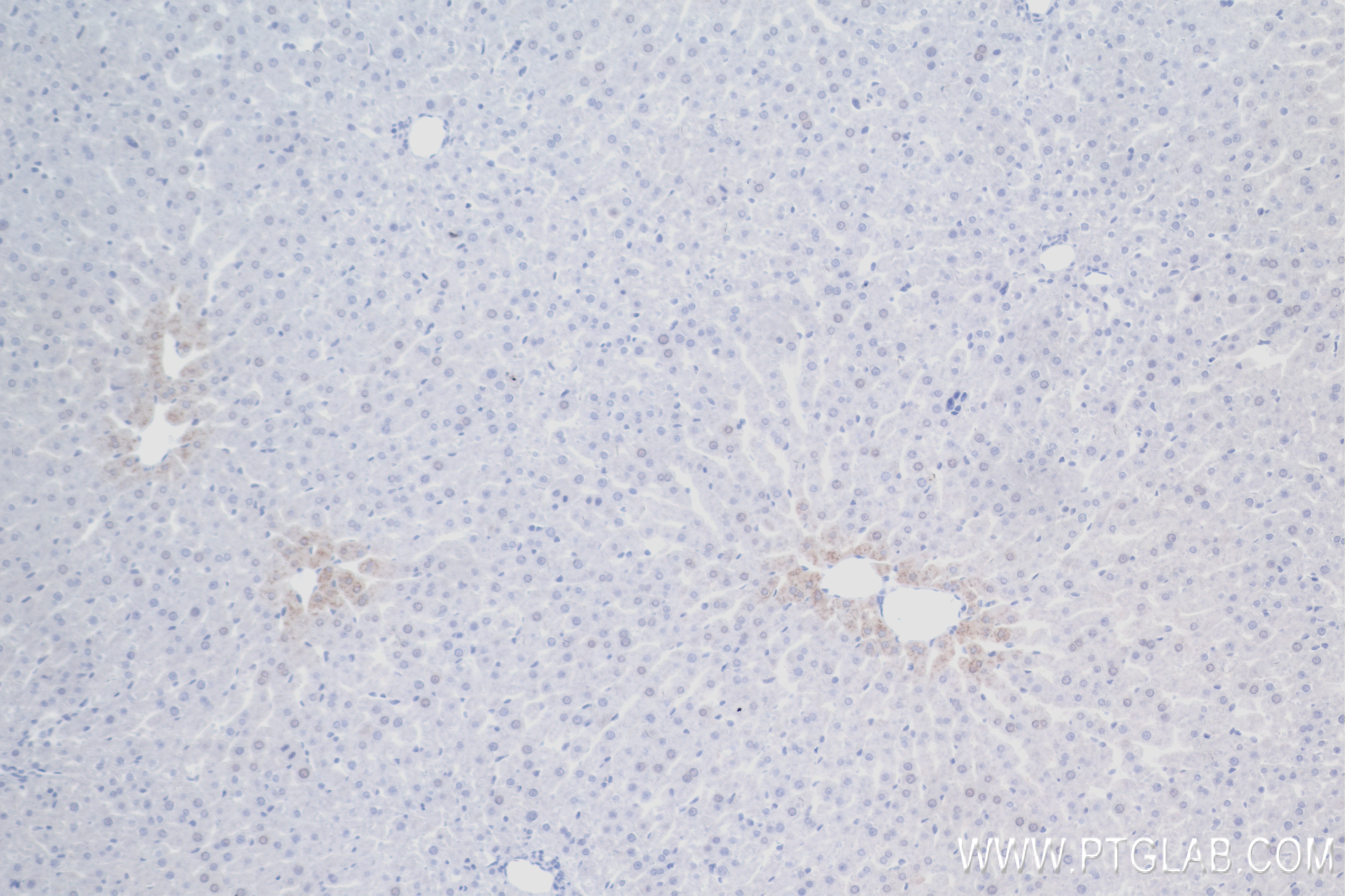 Immunohistochemistry (IHC) staining of rat liver tissue using CPN1 Recombinant antibody (84218-1-RR)