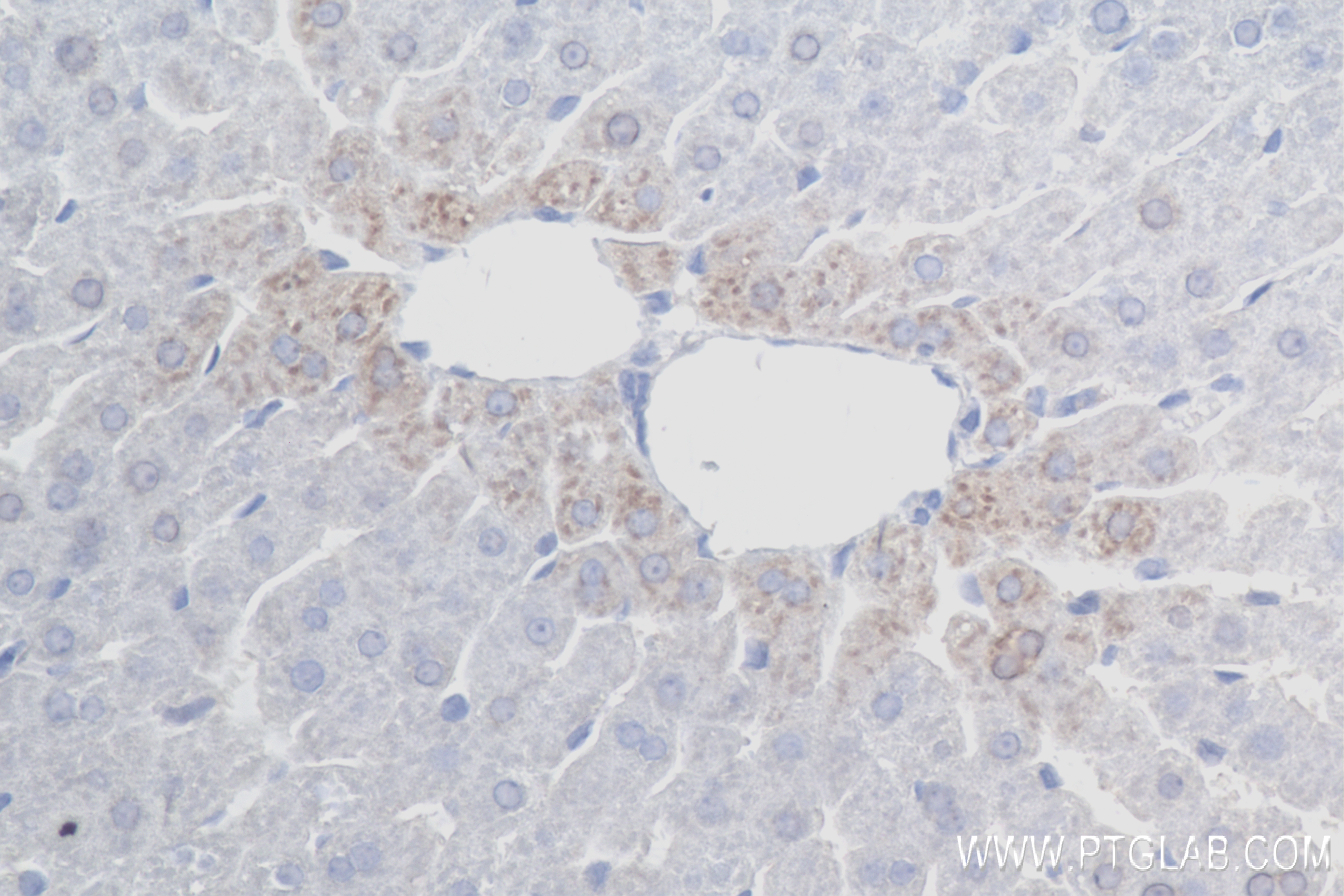 Immunohistochemistry (IHC) staining of rat liver tissue using CPN1 Recombinant antibody (84218-1-RR)