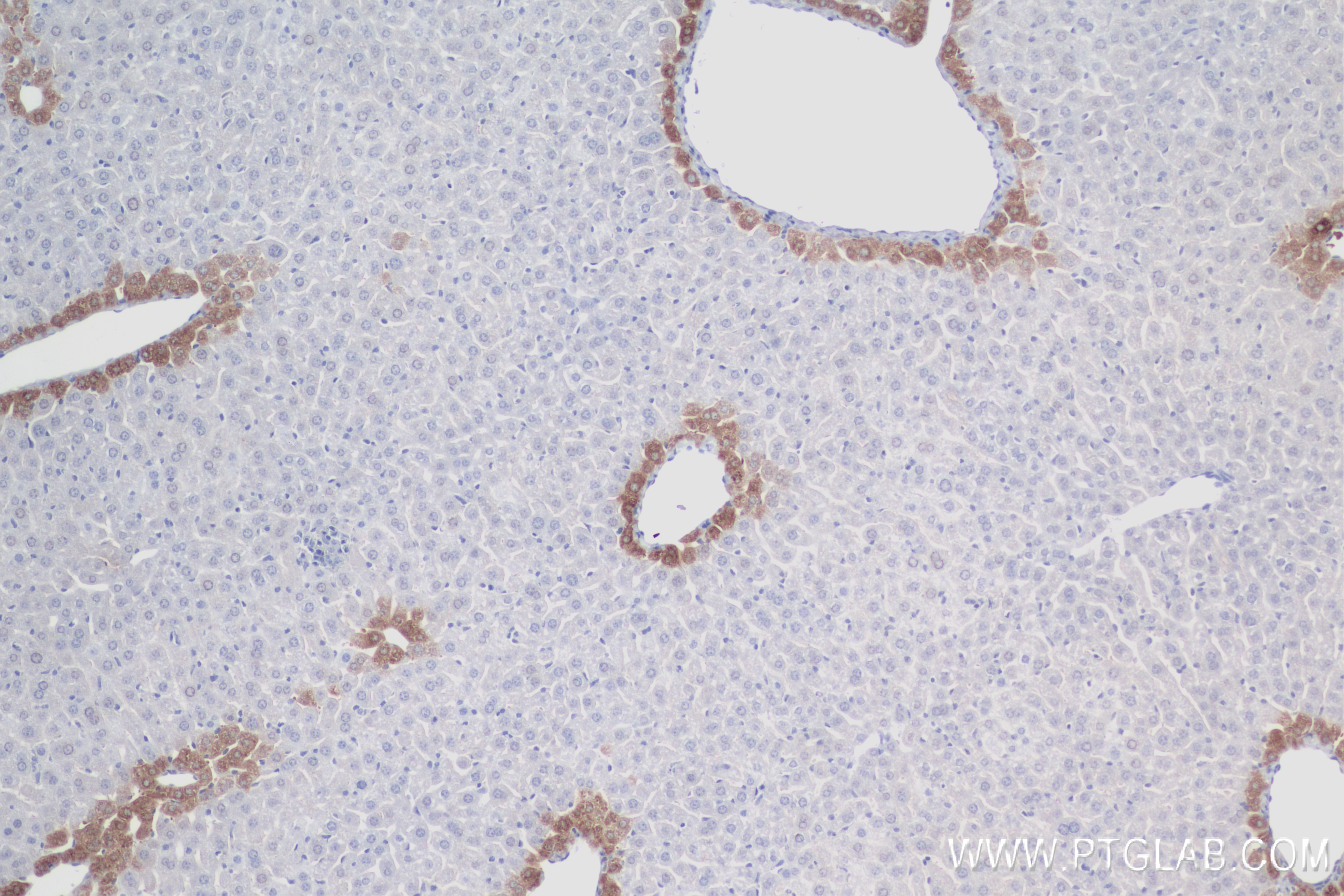 Immunohistochemistry (IHC) staining of mouse liver tissue using CPN1 Recombinant antibody (84218-1-RR)