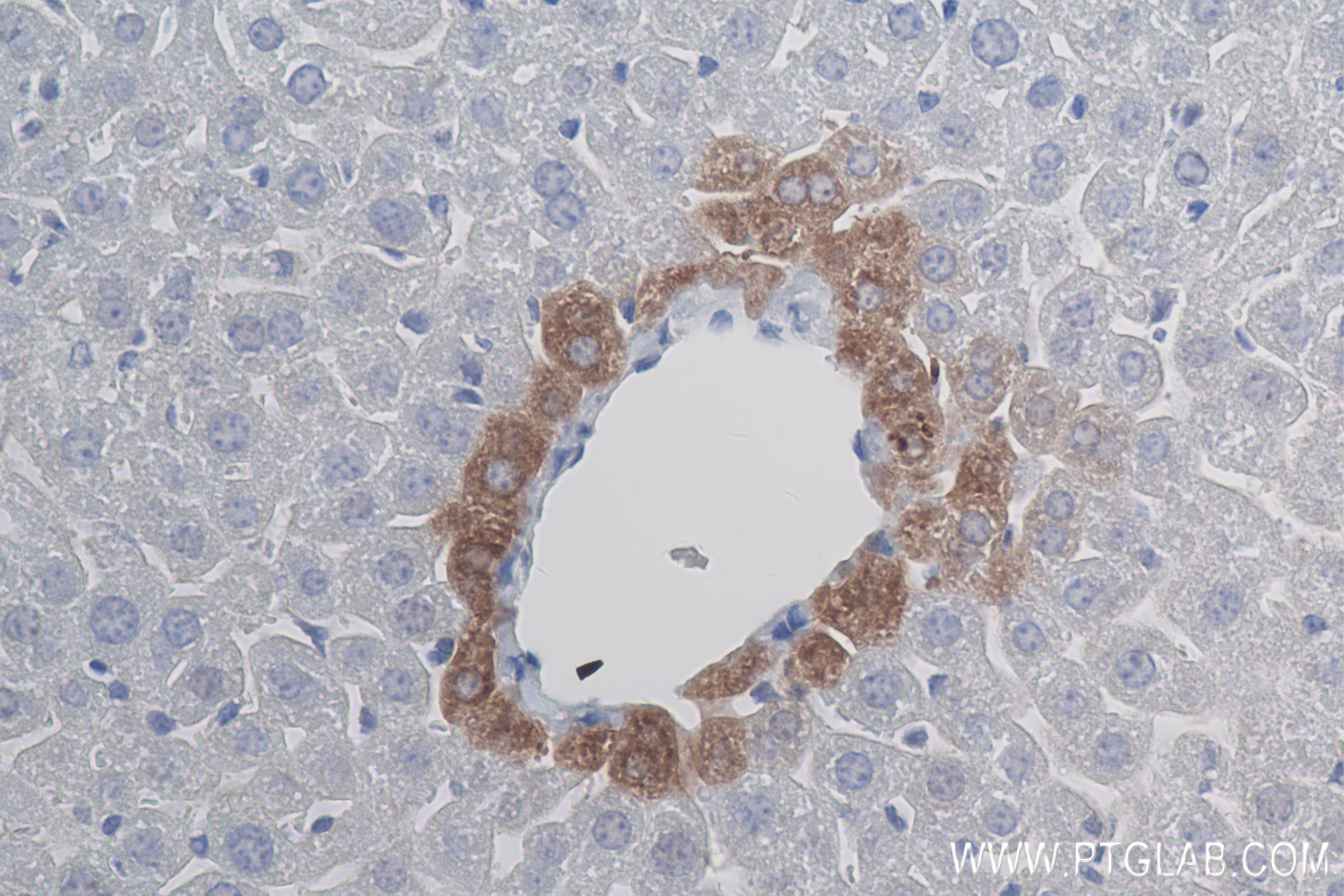 Immunohistochemistry (IHC) staining of mouse liver tissue using CPN1 Recombinant antibody (84218-1-RR)