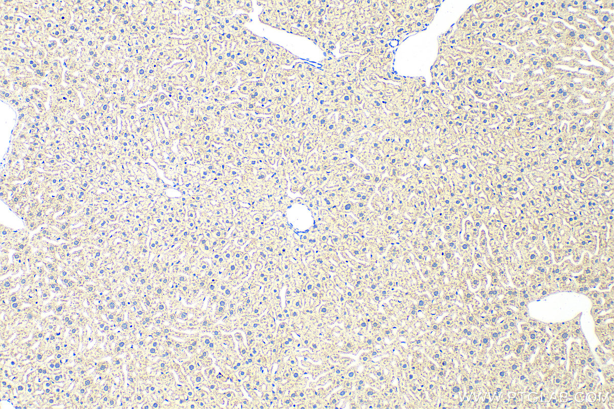 Immunohistochemistry (IHC) staining of mouse liver tissue using CPNE3 Polyclonal antibody (11186-1-AP)