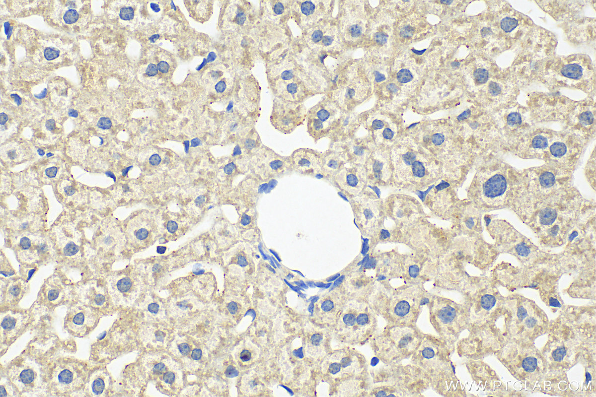 Immunohistochemistry (IHC) staining of mouse liver tissue using CPNE3 Polyclonal antibody (11186-1-AP)