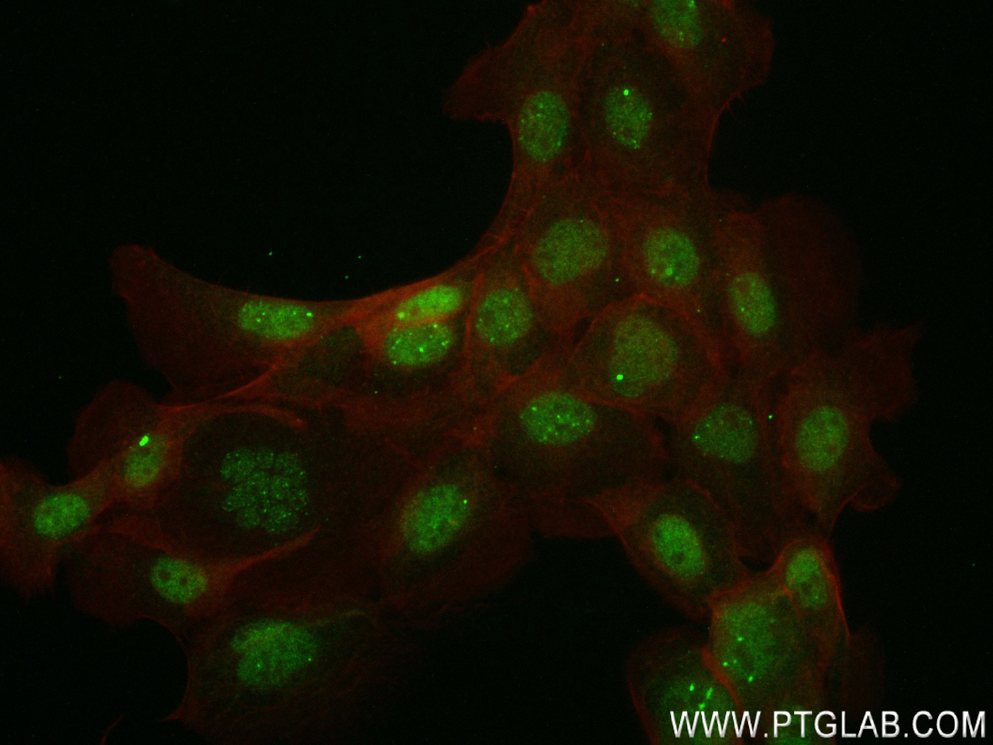 Immunofluorescence (IF) / fluorescent staining of A431 cells using CPNE3 Recombinant antibody (83820-5-RR)