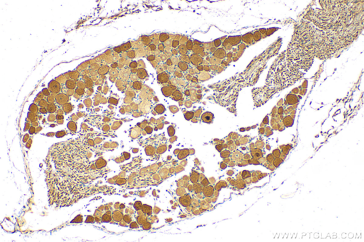 Immunohistochemistry (IHC) staining of rat dorsal root ganglion tissue using CPNE6 Polyclonal antibody (13782-1-AP)