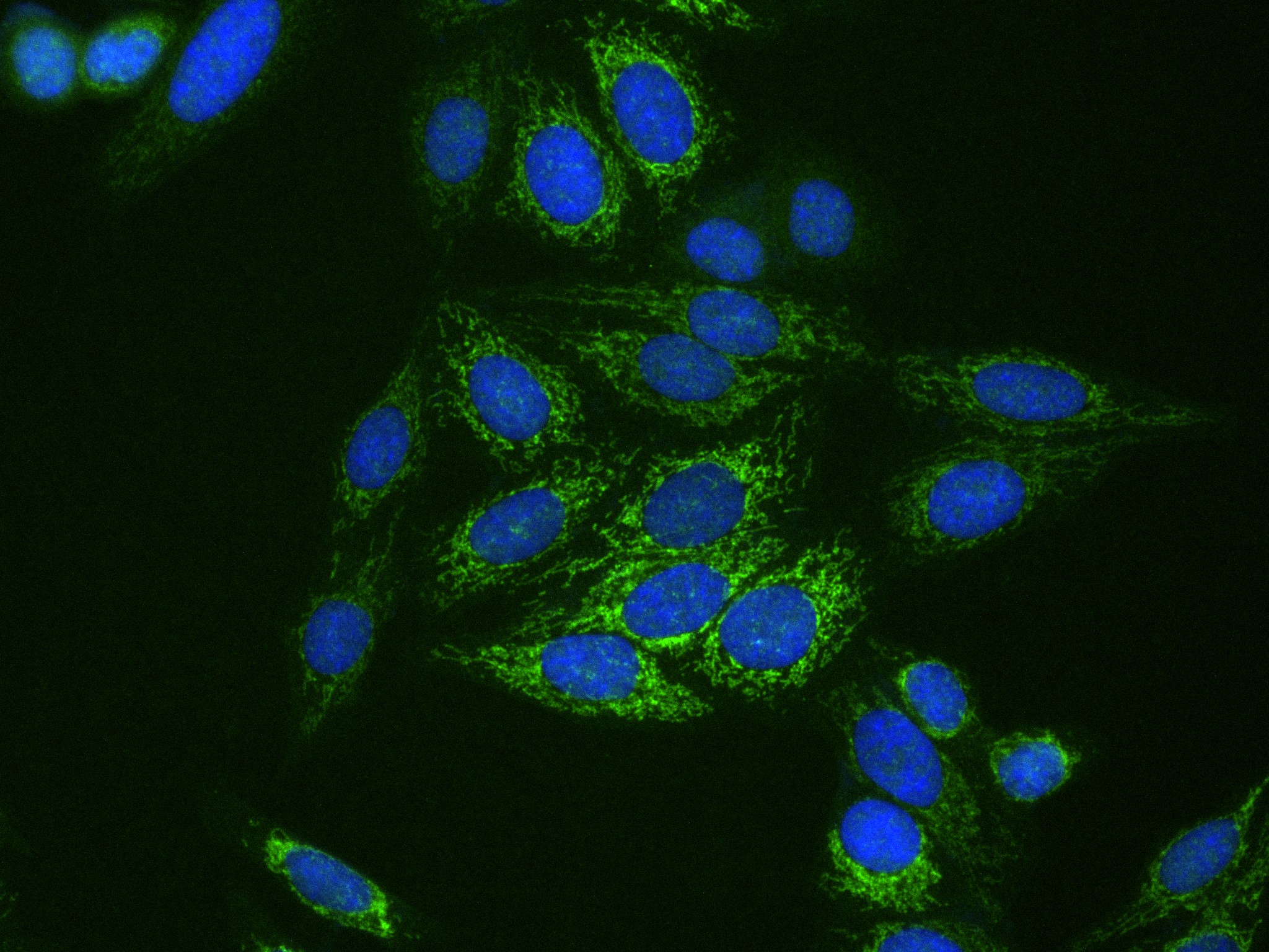 Immunofluorescence (IF) / fluorescent staining of HepG2 cells using CPS1 Recombinant antibody (84277-1-RR)