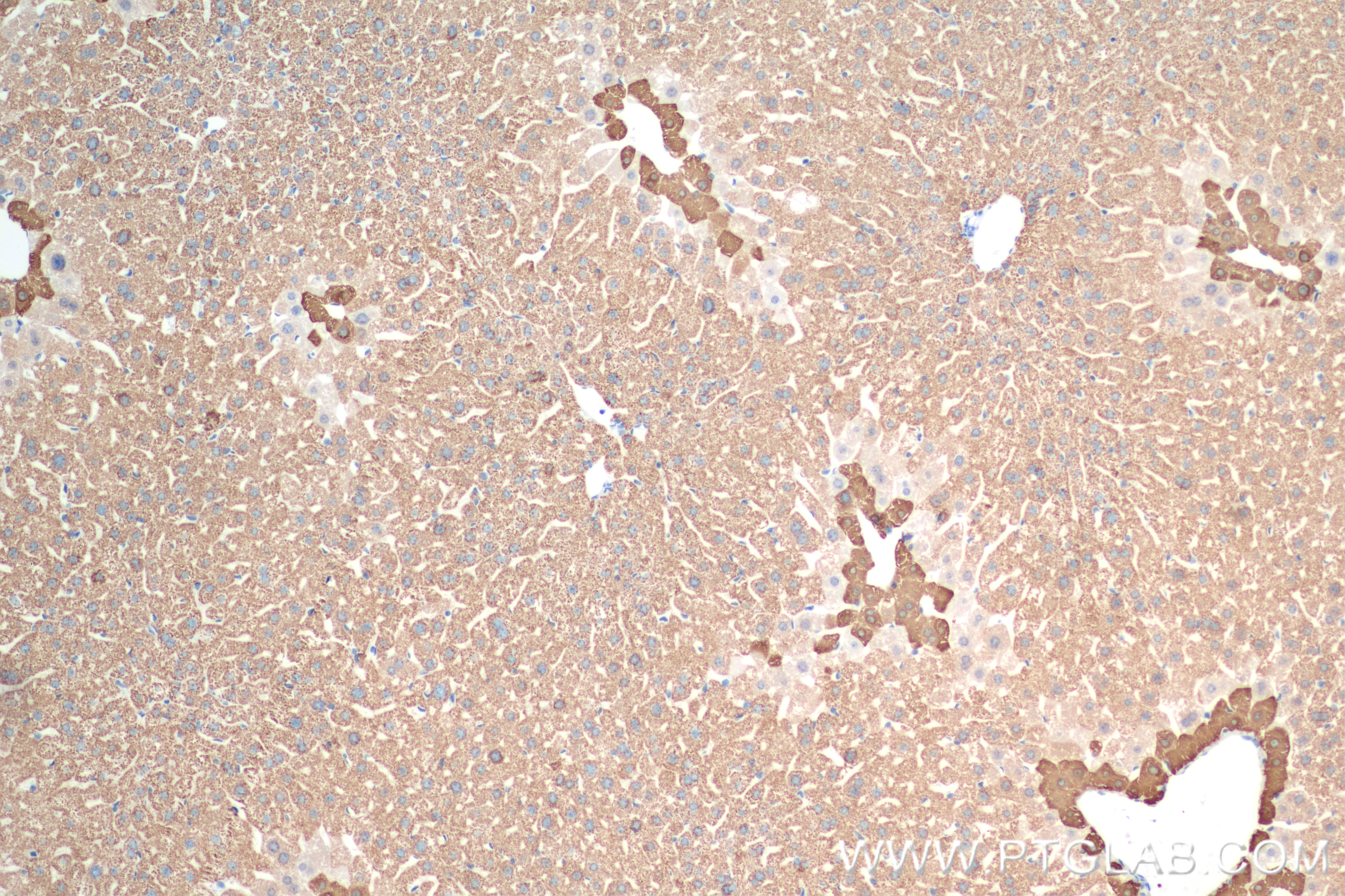 Immunohistochemistry (IHC) staining of mouse liver tissue using CPS1 Recombinant antibody (84277-1-RR)