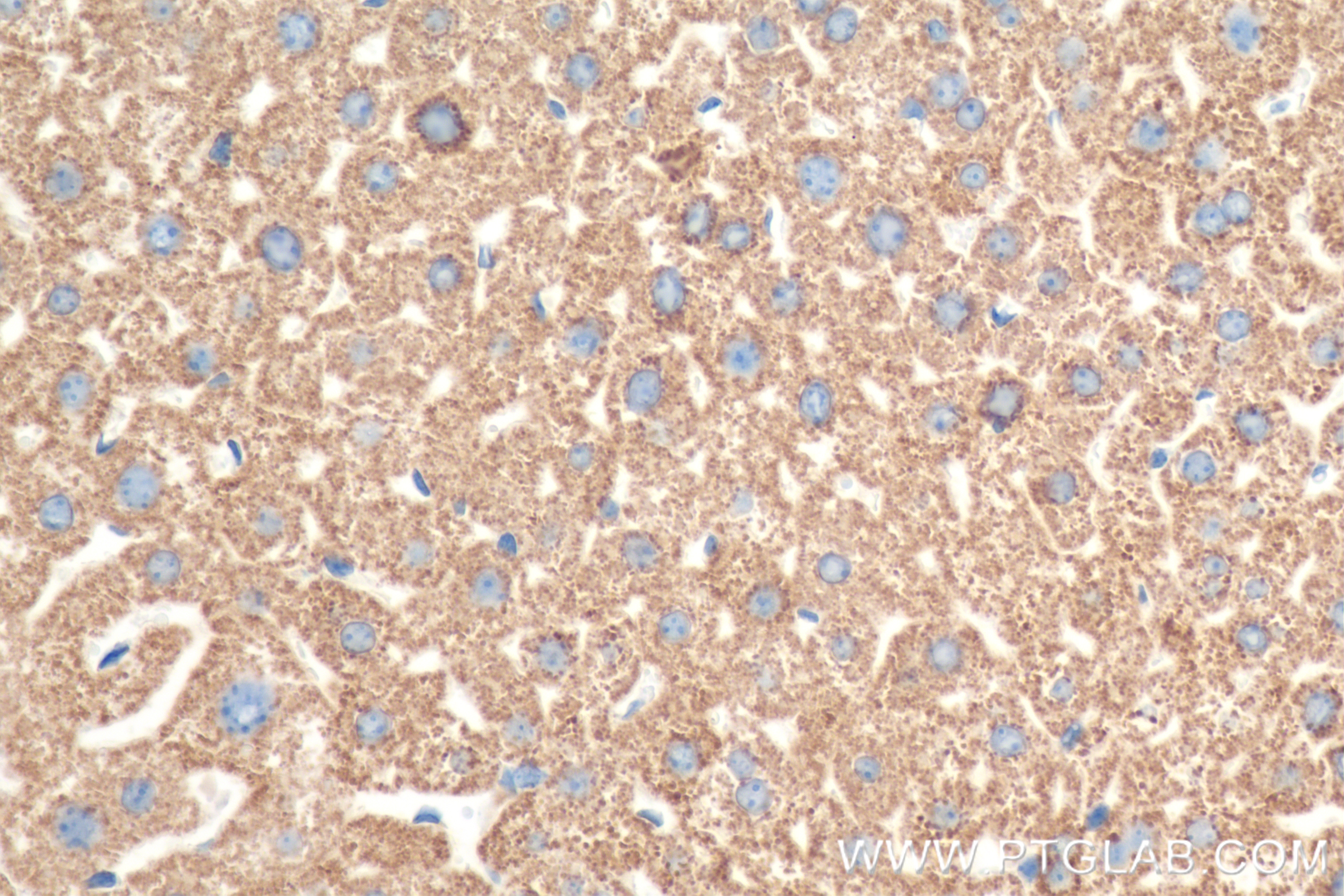 Immunohistochemistry (IHC) staining of mouse liver tissue using CPS1 Recombinant antibody (84277-1-RR)