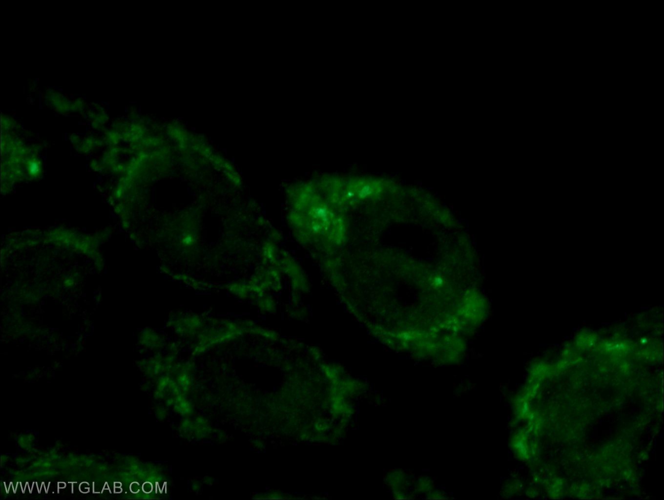 Immunofluorescence (IF) / fluorescent staining of HepG2 cells using CPSF2 Polyclonal antibody (17739-1-AP)