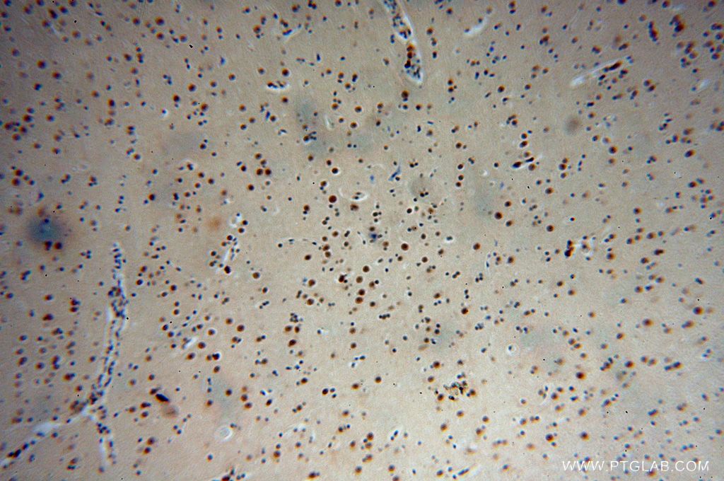 Immunohistochemistry (IHC) staining of human brain tissue using CPSF2 Polyclonal antibody (17739-1-AP)