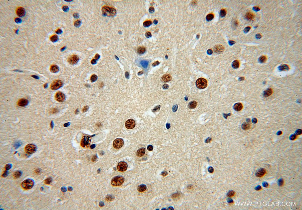 Immunohistochemistry (IHC) staining of human brain tissue using CPSF2 Polyclonal antibody (17739-1-AP)