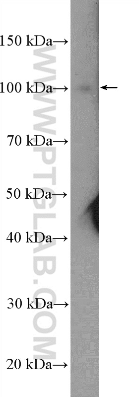 Western Blot (WB) analysis of mouse brain tissue using CPSF2 Polyclonal antibody (17739-1-AP)