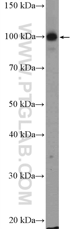 Western Blot (WB) analysis of HeLa cells using CPSF2 Polyclonal antibody (17739-1-AP)