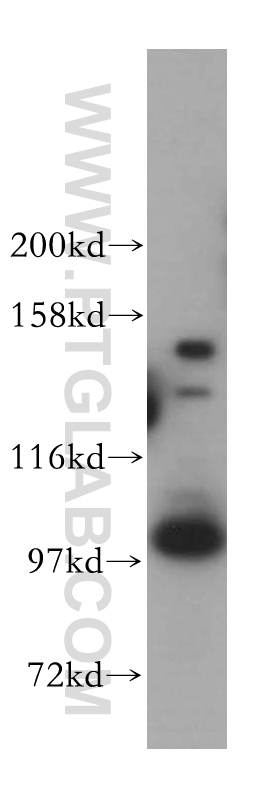 Western Blot (WB) analysis of HeLa cells using CPSF2 Polyclonal antibody (17739-1-AP)