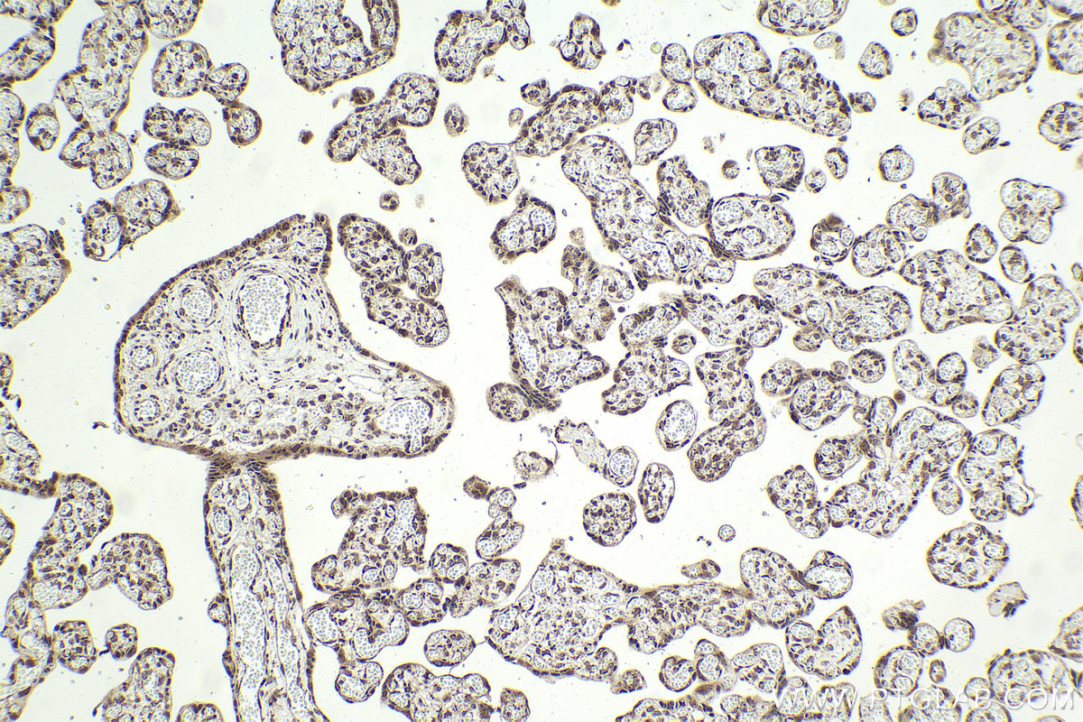 Immunohistochemistry (IHC) staining of human placenta tissue using CPSF3 Polyclonal antibody (11609-1-AP)