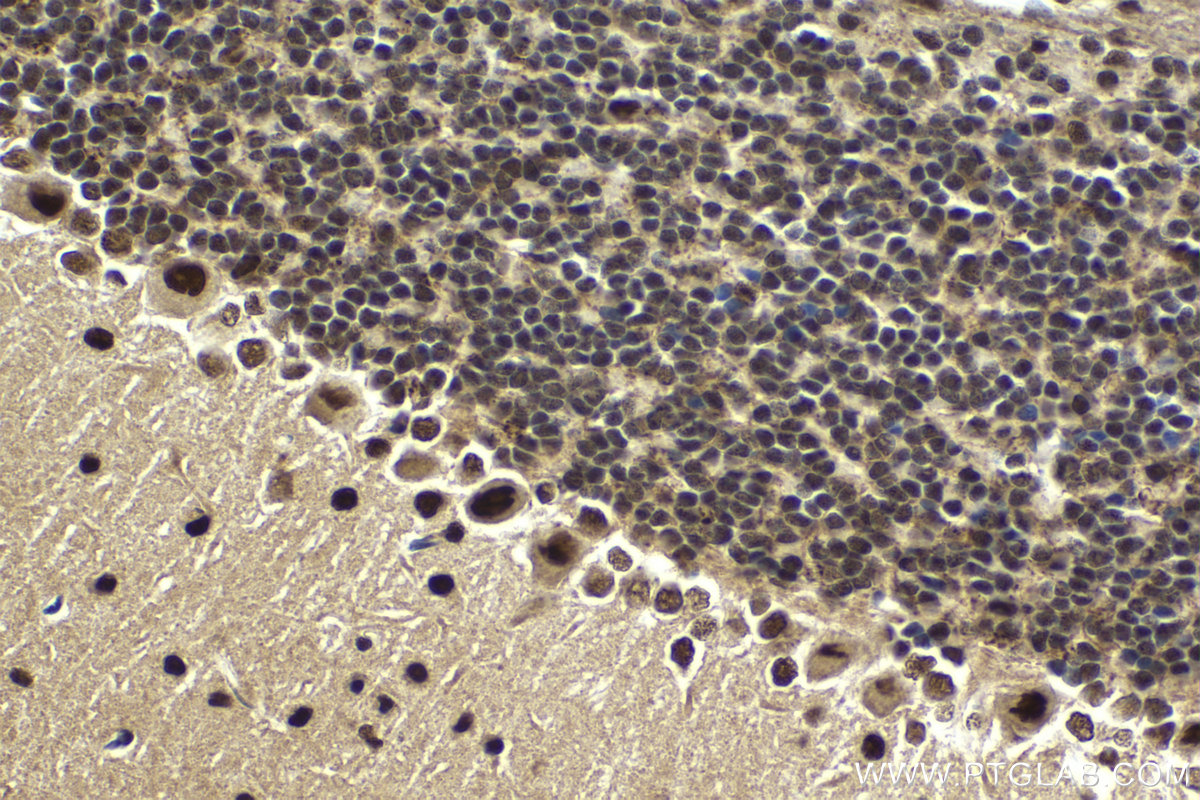 Immunohistochemistry (IHC) staining of mouse cerebellum tissue using CPSF3 Polyclonal antibody (11609-1-AP)
