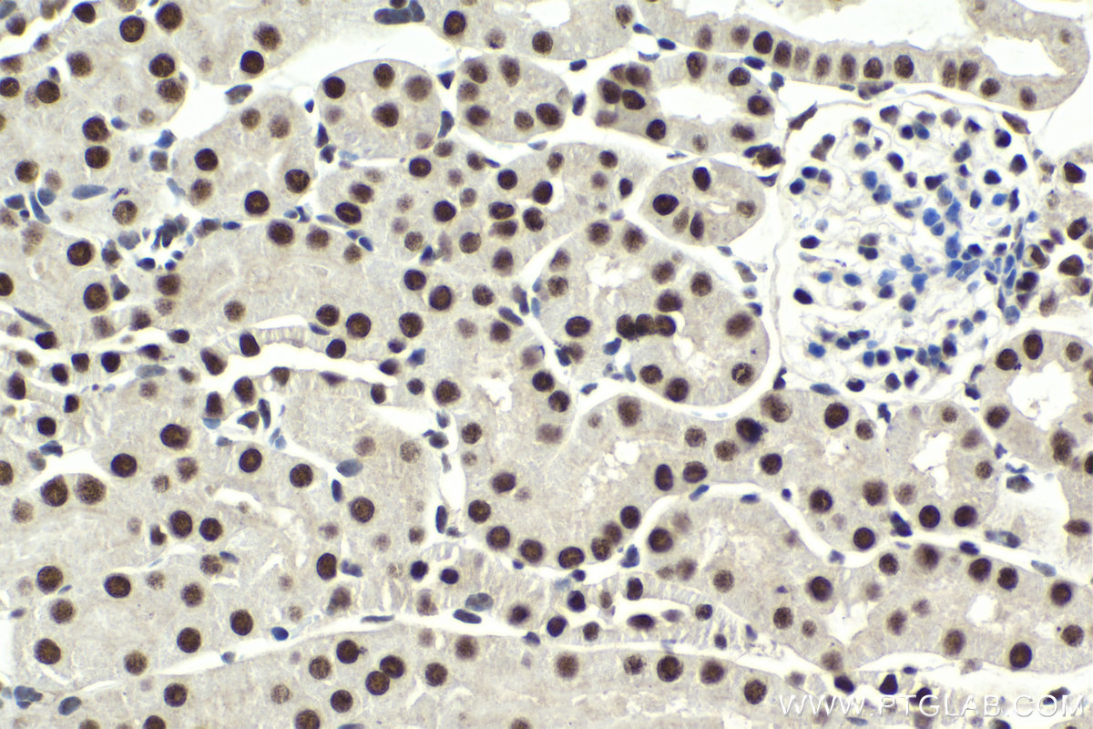 Immunohistochemistry (IHC) staining of mouse kidney tissue using CPSF3 Polyclonal antibody (11609-1-AP)