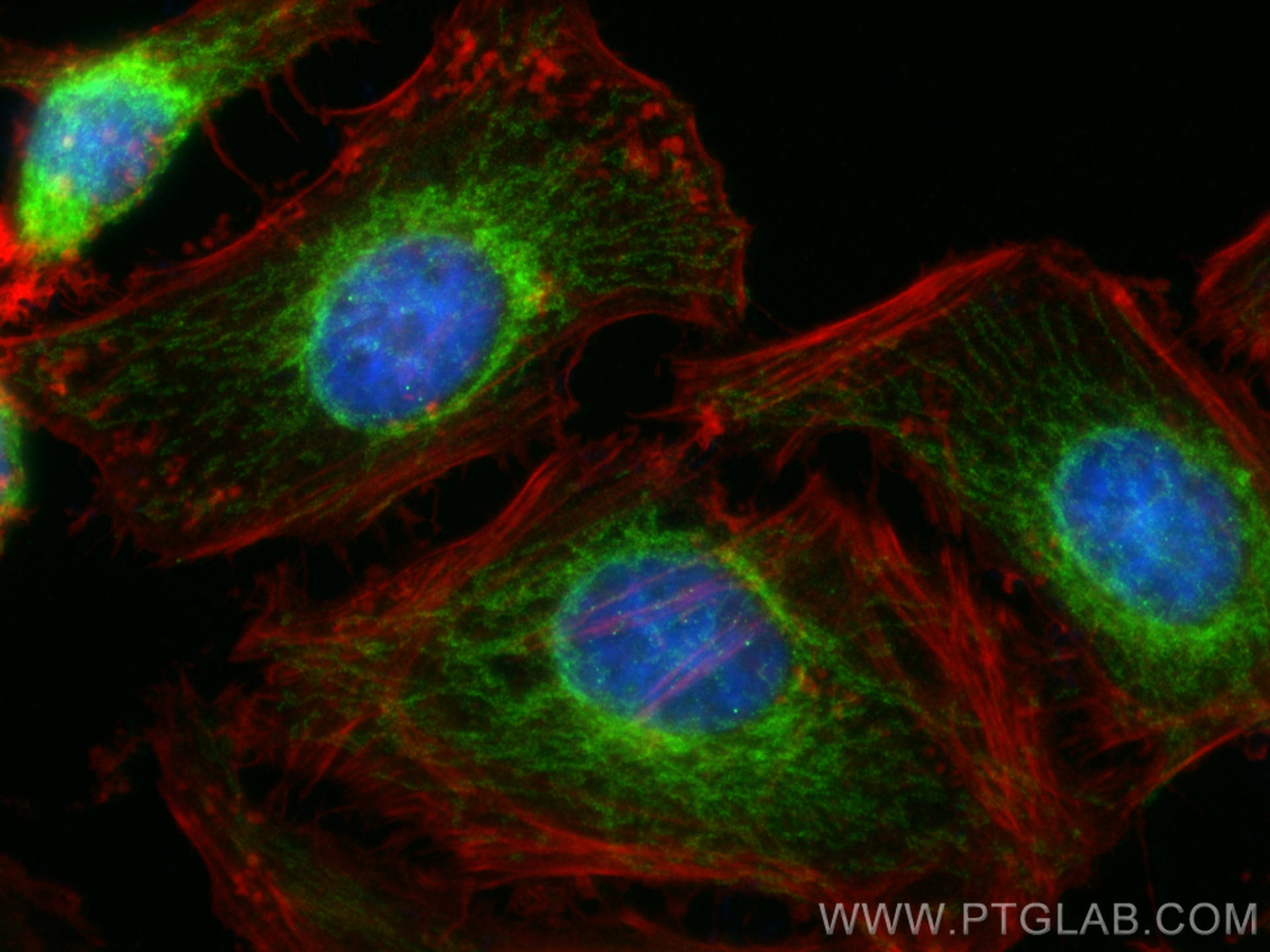 Immunofluorescence (IF) / fluorescent staining of HeLa cells using CPT1A Polyclonal antibody (15184-1-AP)