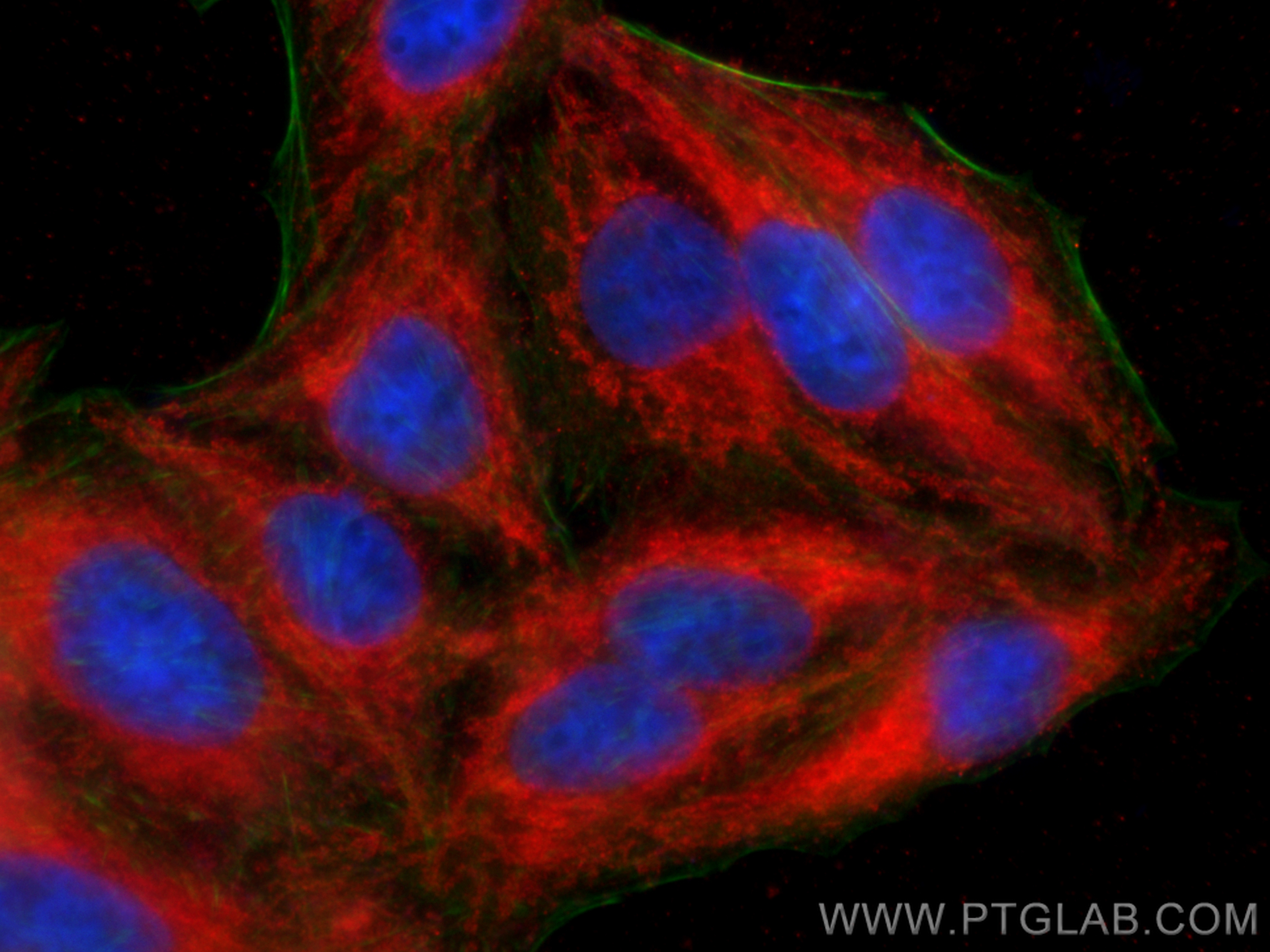 Immunofluorescence (IF) / fluorescent staining of HepG2 cells using CPT1A Polyclonal antibody (15184-1-AP)