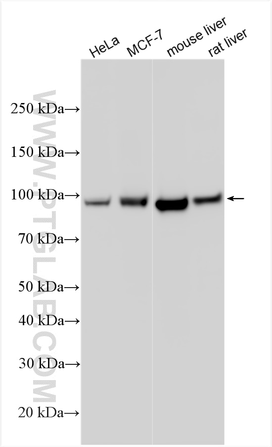 Western Blot (WB) analysis of various lysates using CPT1A Polyclonal antibody (15184-1-AP)