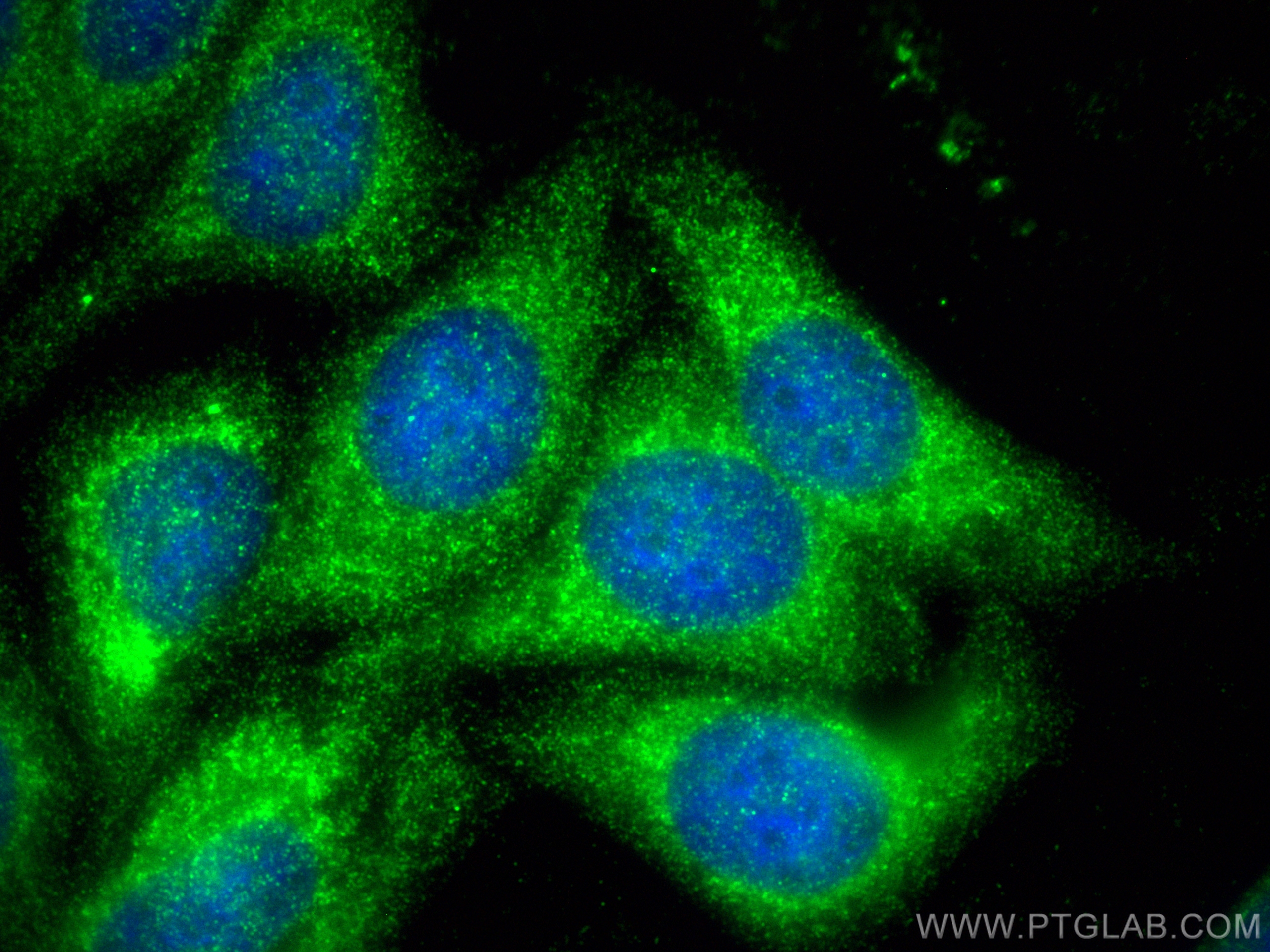 Immunofluorescence (IF) / fluorescent staining of HepG2 cells using CPT1A Monoclonal antibody (66039-1-Ig)