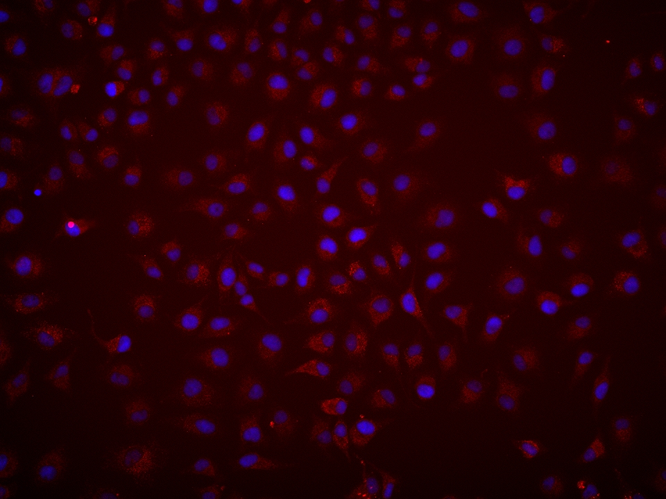 Immunofluorescence (IF) / fluorescent staining of HeLa cells using CPT1A Monoclonal antibody (66039-1-Ig)