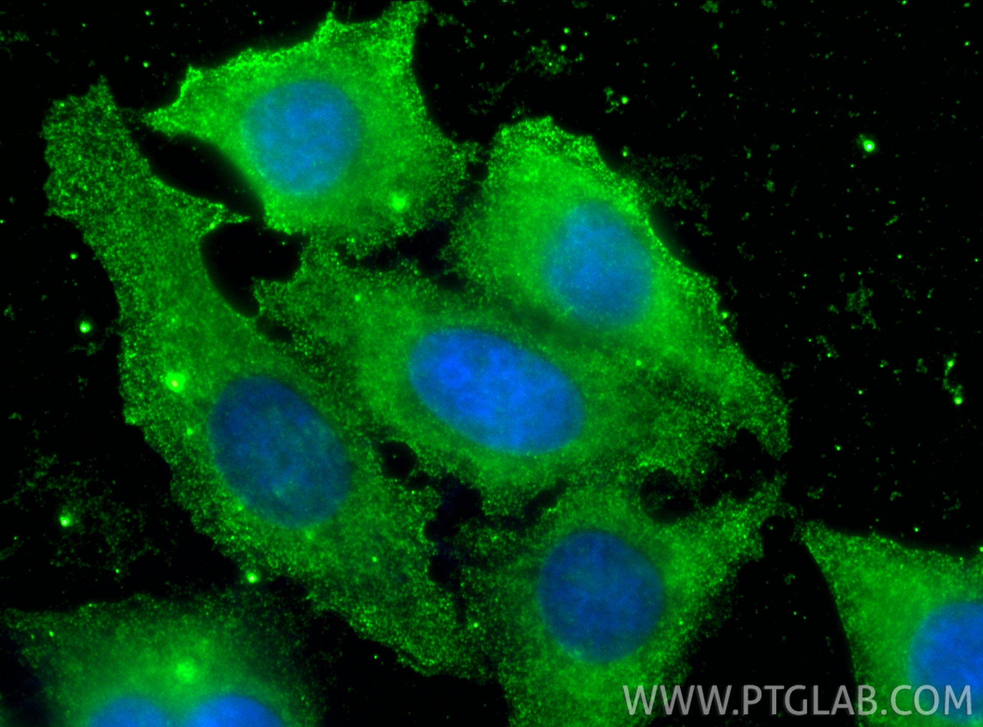 Immunofluorescence (IF) / fluorescent staining of HepG2 cells using CPT1A Monoclonal antibody (66039-3-Ig)