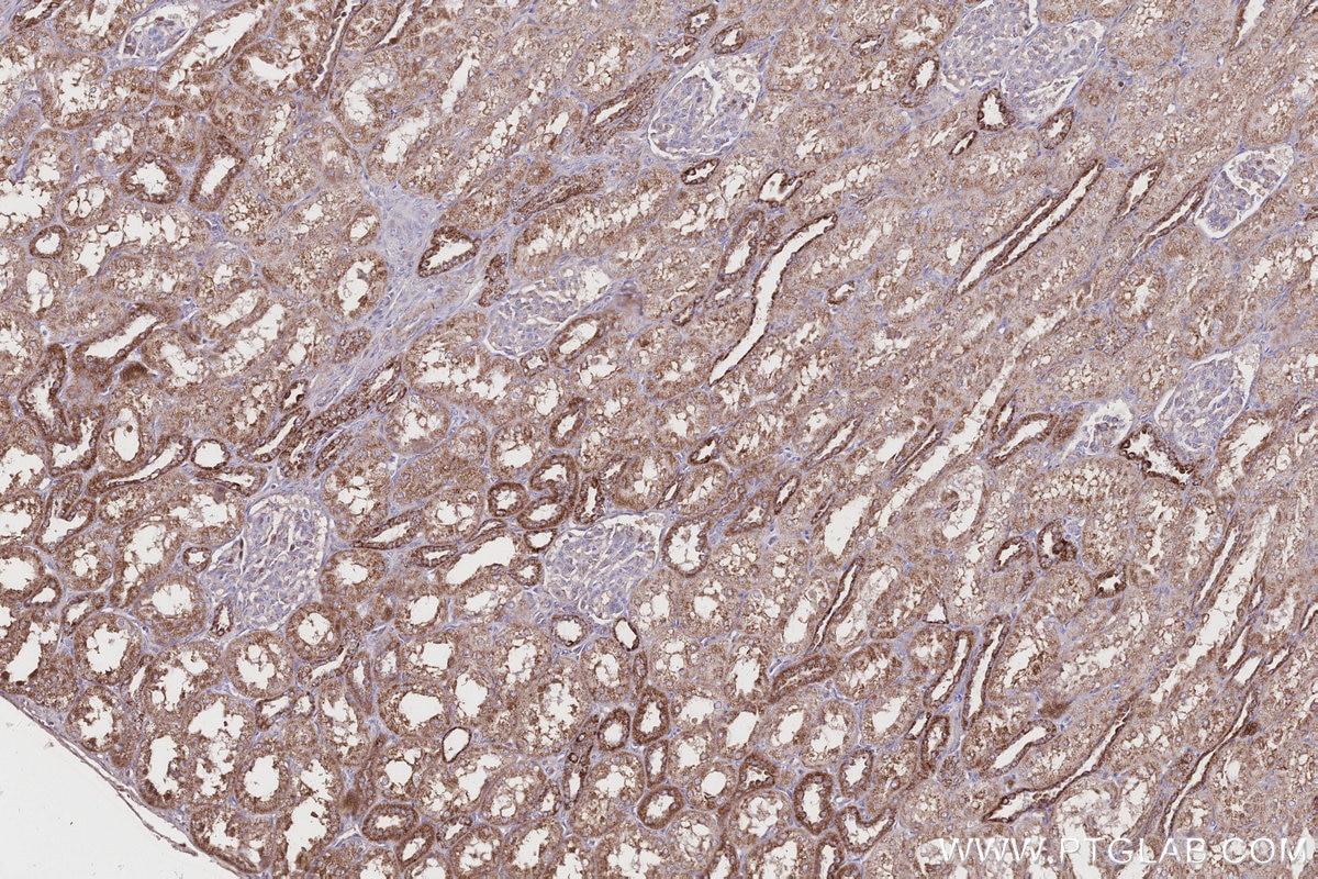 Immunohistochemistry (IHC) staining of human kidney tissue using CPT1A Monoclonal antibody (66039-3-Ig)