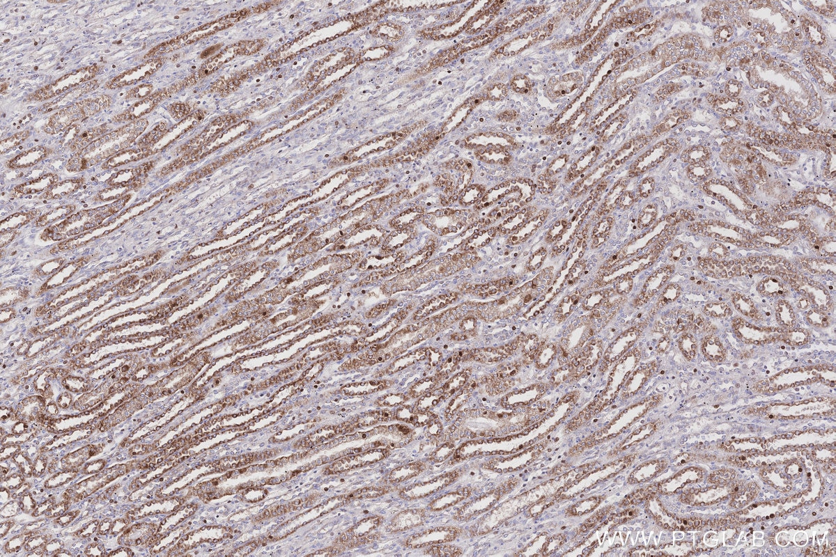 Immunohistochemistry (IHC) staining of human kidney tissue using CPT1A Monoclonal antibody (66039-3-Ig)