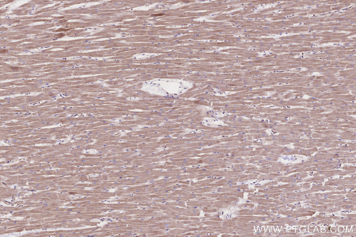 Immunohistochemistry (IHC) staining of human heart tissue using CPT1A Monoclonal antibody (66039-3-Ig)