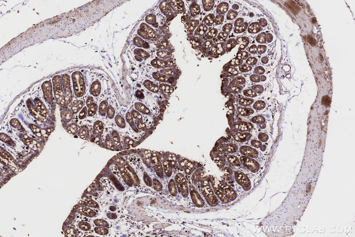 Immunohistochemistry (IHC) staining of mouse colon tissue using CPT1A Monoclonal antibody (66039-3-Ig)