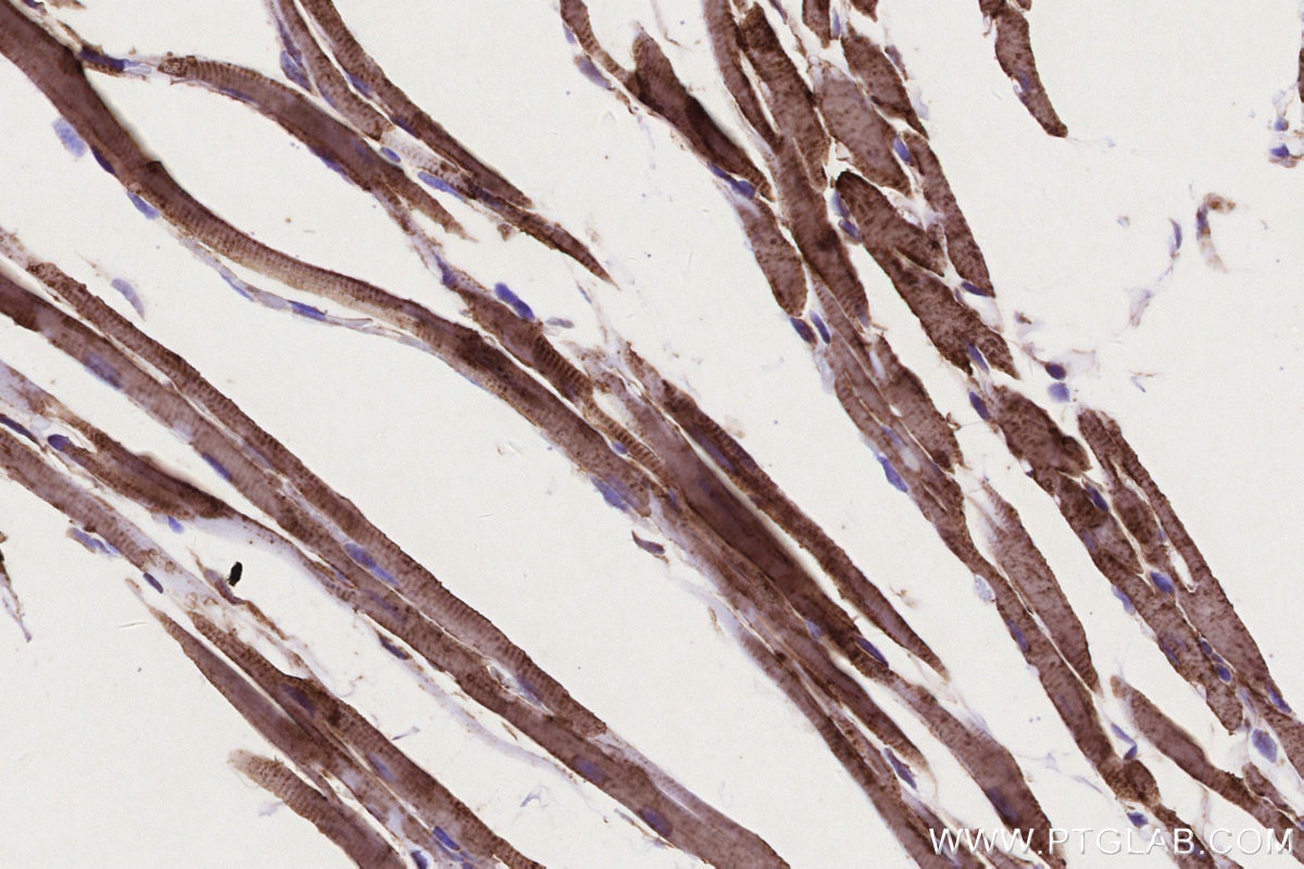 Immunohistochemistry (IHC) staining of mouse heart tissue using CPT1A Monoclonal antibody (66039-3-Ig)