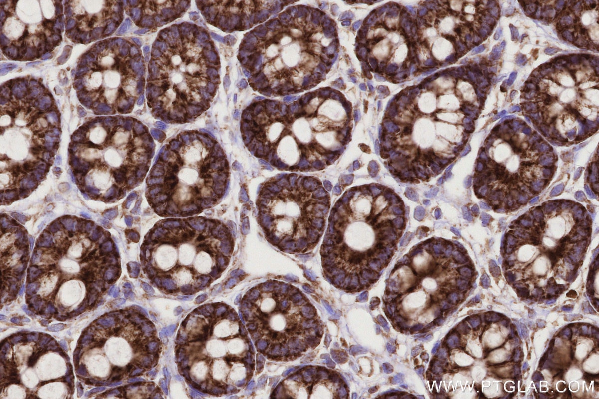 Immunohistochemistry (IHC) staining of rat colon tissue using CPT1A Monoclonal antibody (66039-3-Ig)