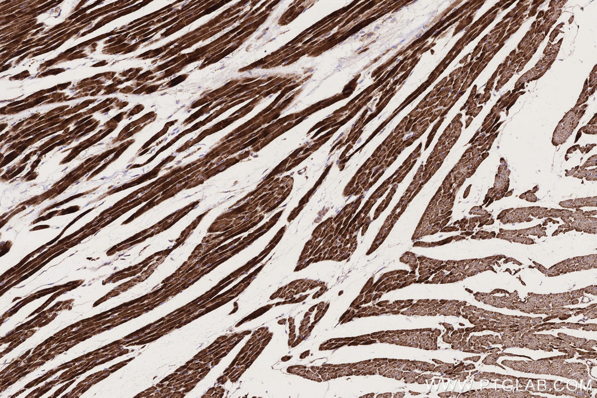Immunohistochemistry (IHC) staining of rat heart tissue using CPT1A Monoclonal antibody (66039-3-Ig)
