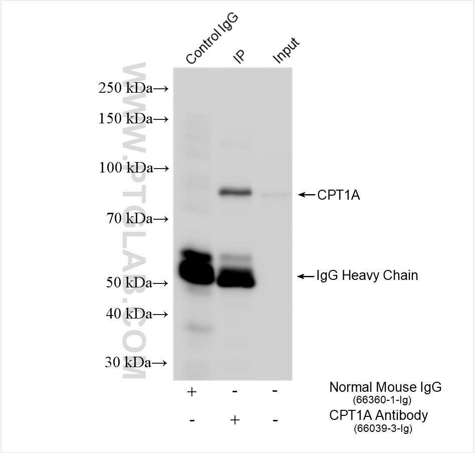 Immunoprecipitation (IP) experiment of HepG2 cells using CPT1A Monoclonal antibody (66039-3-Ig)