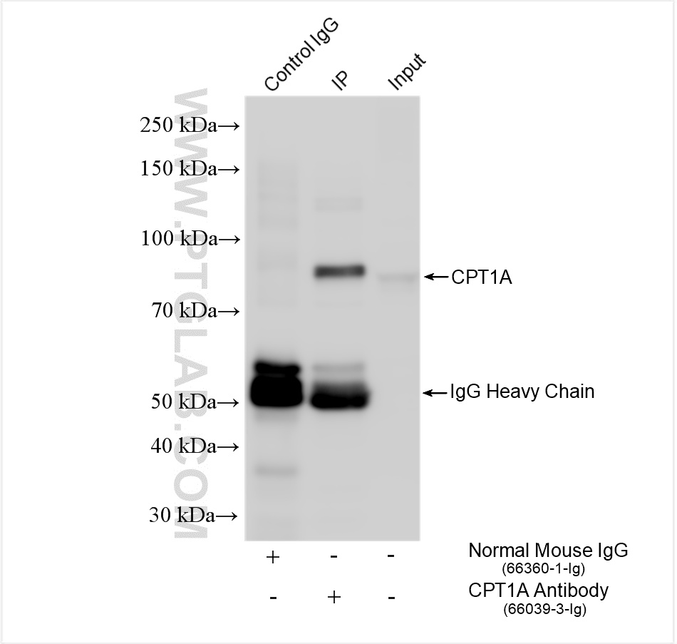 Immunoprecipitation (IP) experiment of MCF-7 cells using CPT1A Monoclonal antibody (66039-3-Ig)