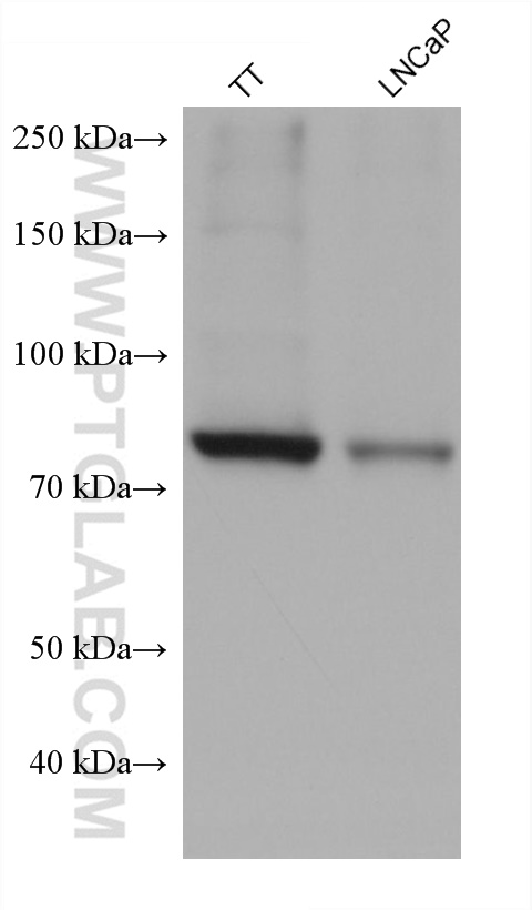 Western Blot (WB) analysis of various lysates using CPT1A Monoclonal antibody (66039-3-Ig)