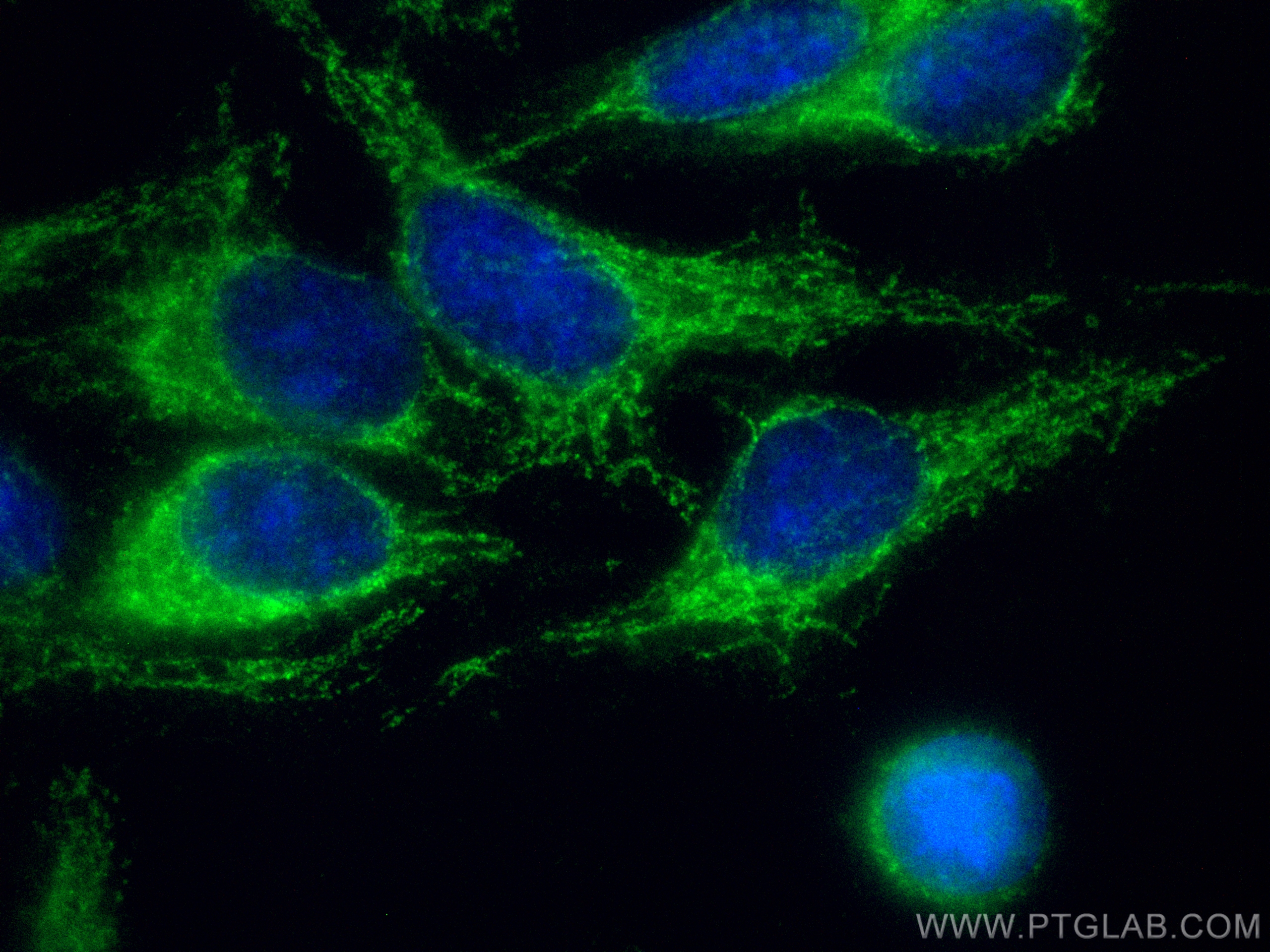 Immunofluorescence (IF) / fluorescent staining of HepG2 cells using CoraLite® Plus 488-conjugated CPT1A Polyclonal ant (CL488-15184)